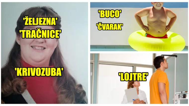 Ako ste nosili aparatić, usporedbe s tračnicama HŽ-a bile su neizbježne: Sva dječja ruganja kojih se nerado sjetimo