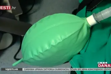 Svjetski uspjeh hrvatskih liječnika! Sveti Duh jedini izvodi operacije uz ove posebne naočale