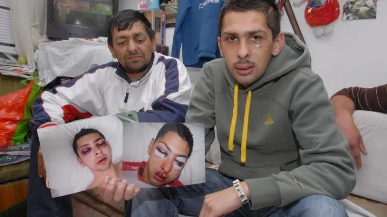 Bivši policajac mora isplatiti novčanu naknadu u iznosu od oko 54.000 kuna jer je pretukao mladića