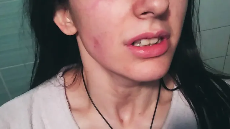 Kći i majka napadnute u Varaždinu: 'Jo&scaron; smo u &scaron;oku, mama se trese i ne mogu je smiriti'