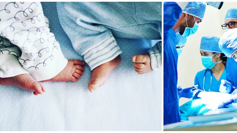 Veliki uspjeh hrvatskih liječnika! Uspje&scaron;no razdvojili sijamske blizanke rođene s jednim jetrima!