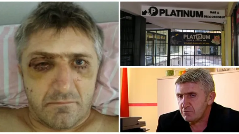 Nasilnicima koji su pretukli za&scaron;titara smanjene kazne! 'Jedva sam preživio...'