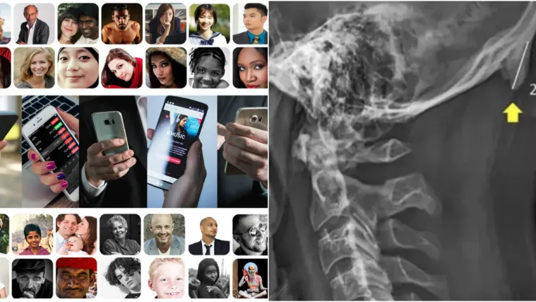 Ljudima rastu 'rogovi' jer su non-stop na mobitelima! Srećom, postoji lijek za takvo stanje