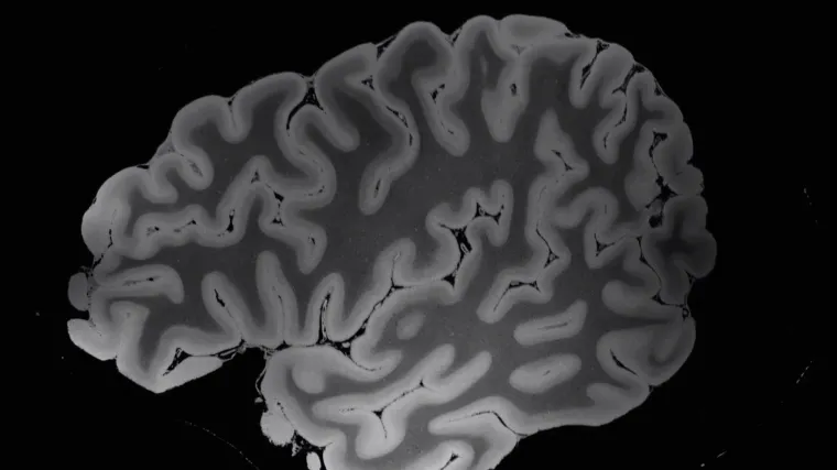 Snimka mozga: Najdetaljniji prikaz misterioznog organa nakon sto sati skeniranja