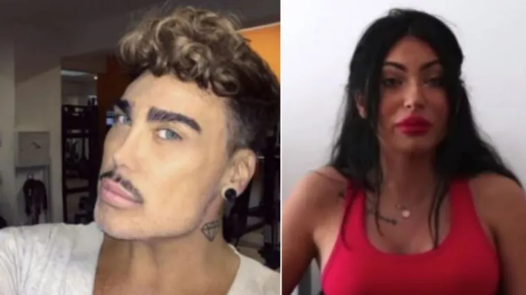 'Cic*e i čube su joj sad izbočene u istoj razini'