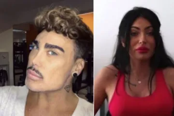 'Cic*e i čube su joj sad izbočene u istoj razini'