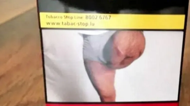 Jeste li vidjeli ovu sliku na cigaretama? Mu&scaron;karac s fotografije nikad nije dao dopu&scaron;tenje da mu slikaju nogu