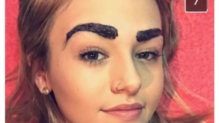 NAJVEĆE 'BEAUTY' KATASTROFE: Željele su se uljepšati, a završile su u suzama