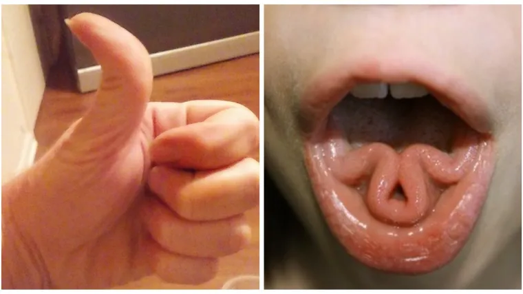 Micanje u&scaron;ima, akrobacije s jezikom i dizanje obrve: 15 sposobnosti koje imaju samo rijetki