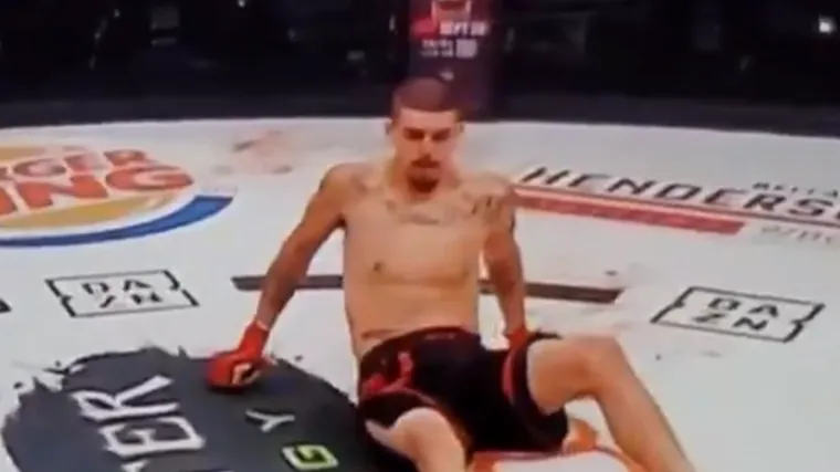 Noga mu se nakon udarca u potpunosti objesila