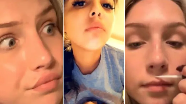 Nemate za filere, a želite da vam usne budu punije? Influencerice imaju novi bizarni trik za siroma&scaron;ne