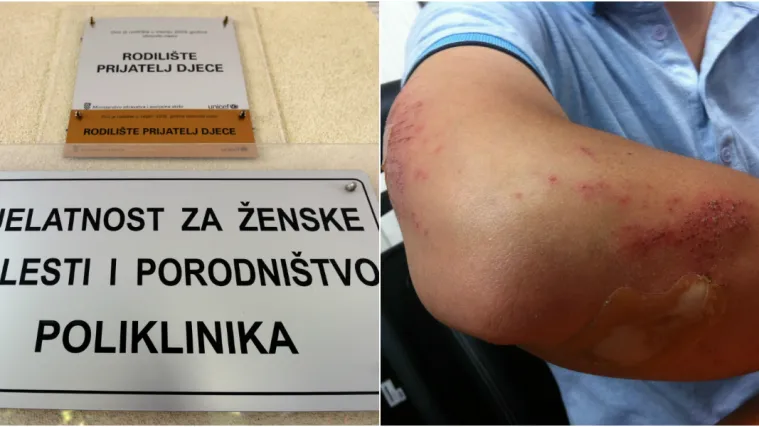 Incident u rodili&scaron;tu! 'Ginekolog me fizički napao!' Odgovor bolnice: 'Morali smo za&scaron;tititi rodilju'