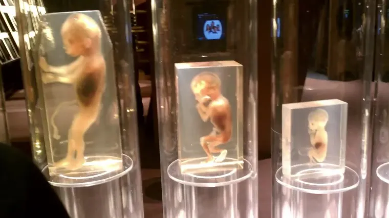 U domu ginekologa prona&scaron;li ostatke 2246 fetusa! Radio pobačaj i djevojčici (10) koju je silovao ujak