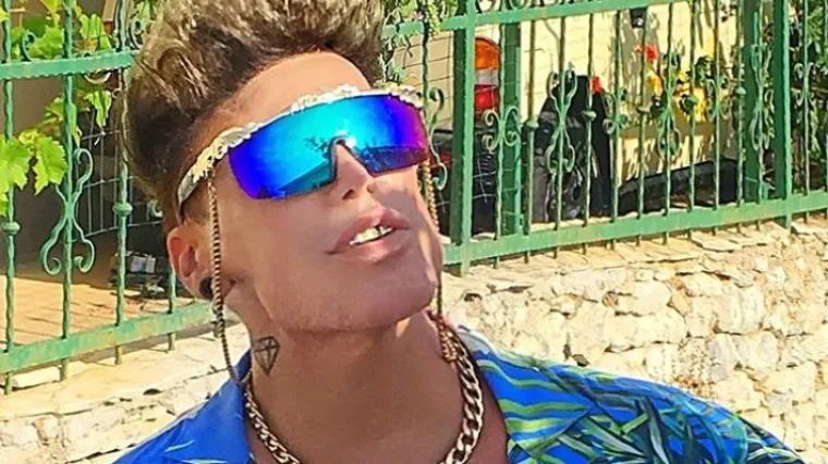 'Ja sam se izoperirao kako bih izgledao savr&scaron;eno, pa ne koristim Photoshop'