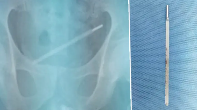 Igrao se pa je toplomjer zavr&scaron;io tamo gdje ne bi ni tehnički trebalo biti moguće