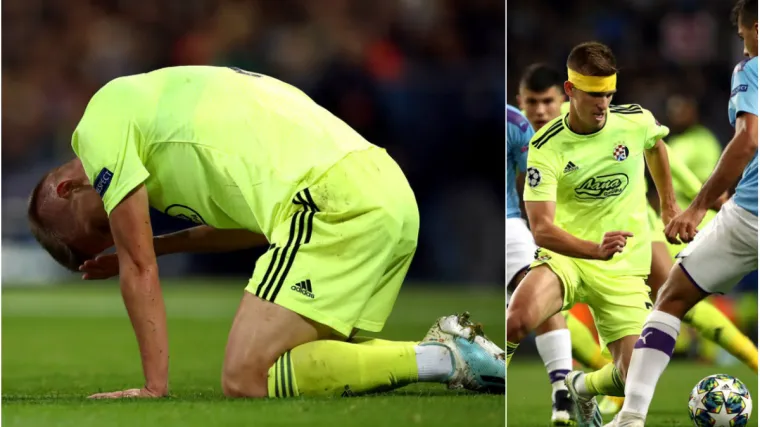 Pogledajte trenutak kad je krvave glave napustio igru