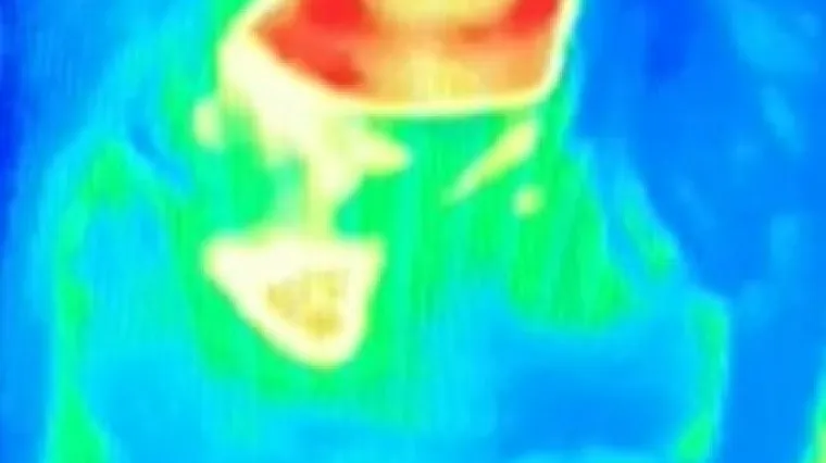 'Tamo su imali tu atrakciju. Vidjela sam čudnu mrlju i oti&scaron;la liječniku...'