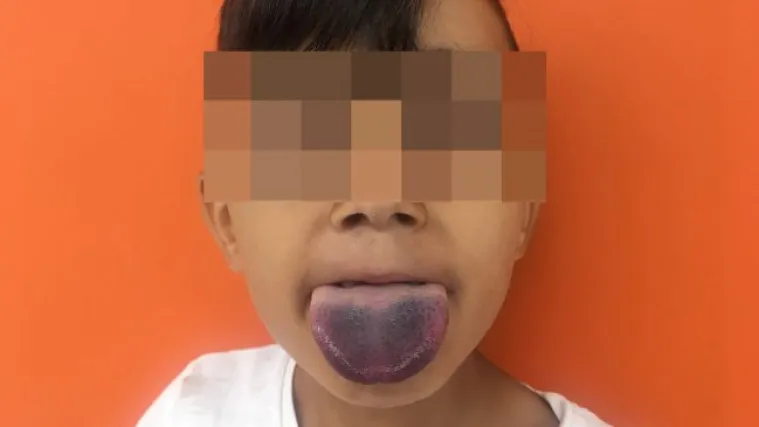 Liječnik inspiraciju prona&scaron;ao u plutenom čepu