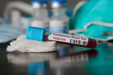 Koronavirus je zarazniji od SARS-a, a strahuje se da je samo u Kini zaraženo 90.000 osoba!?