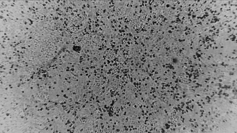 Kad bi njegov vrh mogli ubaciti u ljude, na&scaron;a tijela bi bila otporna na ovu napast