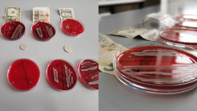 Vreba li koronavirus i s novčanica? Obavili smo laboratorijsku analizu, rezultati su &scaron;okantni!