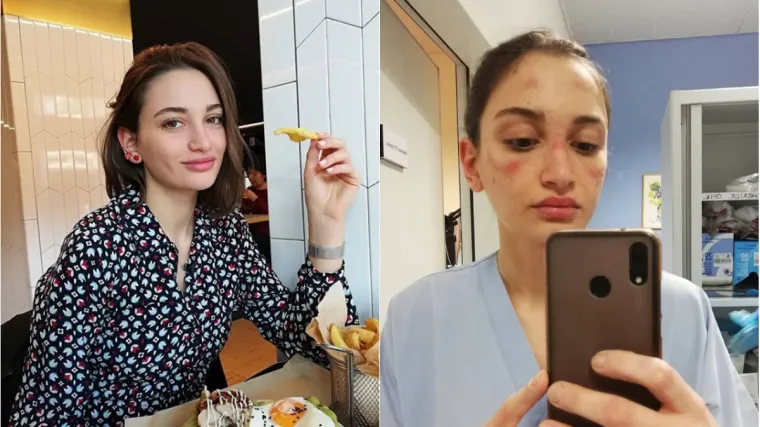 'Oprema nam nanosi bol, znojimo se, &scaron;est sati ne možemo ni&scaron;ta popiti ili otići na WC...'