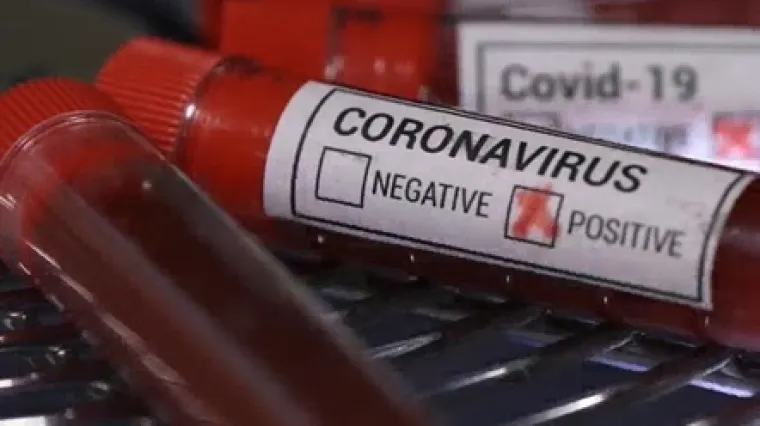 USA UŽIVO: U Hrvatskoj je 27 zaraženih; Do sada je umrlo 4925 ljudi; Merkel: Na&scaron;a je zadaća spasiti ljudske živote