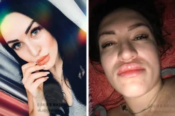 SVIMA RAZOTKRILE SVOJE TAJNE LJEPOTE: Pokazale kako od obične cure postati Instagram model