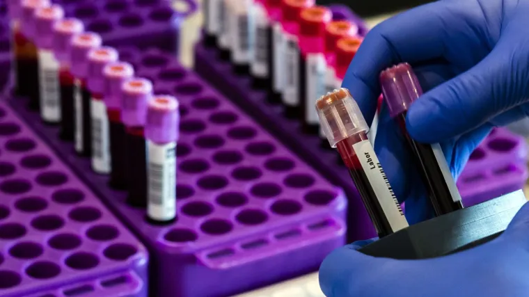 U Rijeci 22 hospitaliziraniih zbog koronavirusa, troje u težem stanju: Među zaraženima i bolnički patolog