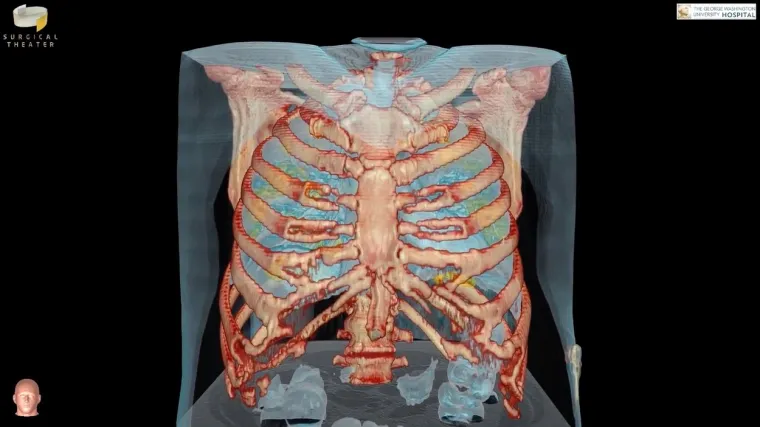 U SAD-u broj zaraženih dosegao 81 tisuću, vi&scaron;e nego u bilo kojoj zemlji svijeta