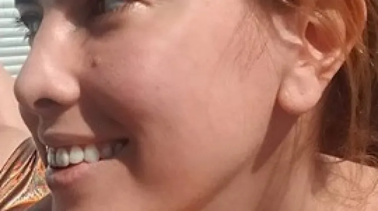 Bolan 'problem' pokazala u toplesu i oskudnim gaćicama, fanovi nude pomoć