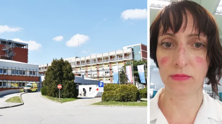 Potresna objava liječnice iz Čakovca: 'Ovo je moje lice nakon 4,5 sata nošenja maske'