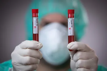 Nizozemci analizirali uzorke davatelja krvi i otkrili koliko ih je već preboljelo koronavirus