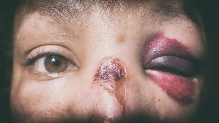 Nije va&scaron; problem? Zamislite da je iza tih zatvorenih vrata, iza kojih se čuju udarci i jauci, va&scaron;a kći