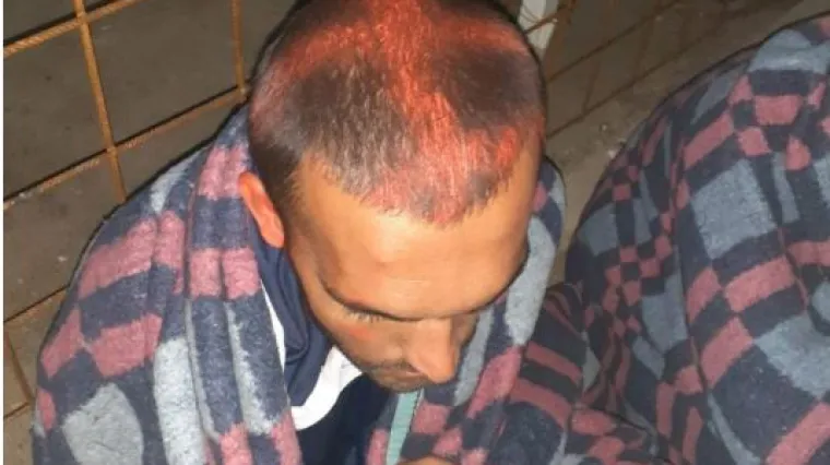 Hrvatska policija sprejem crta križeve na glave migranata? MUP se nije oglasio o slučaju