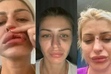 Manekenka objavila video na kojem nasrće na nju; 'Želi mi oduzeti dijete'