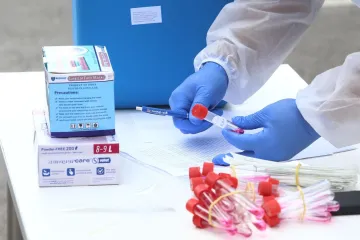 Uzet će uzorke 1100 ispitanika iz različitih županija: Što su serološka testiranja dosad pokazala?