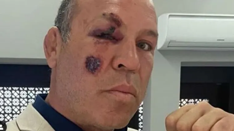 Ovo nije prvi put da mu se to dogodilo