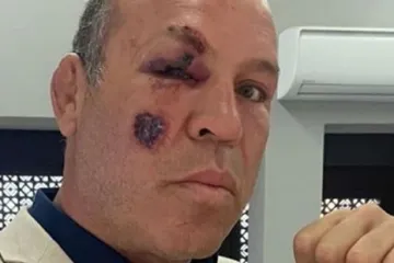 Ovo nije prvi put da mu se to dogodilo