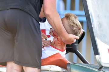 Ugrađene su mu titanske pločice; Prvi doznajemo za koliko se vraća na teren