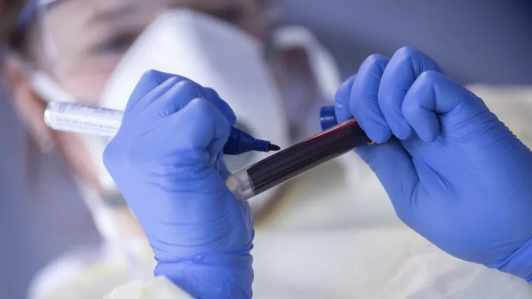 U Srbiji je preko noći koronavirus 'nestao' kod 4000 oboljelih: Sve zbog jednog razloga...