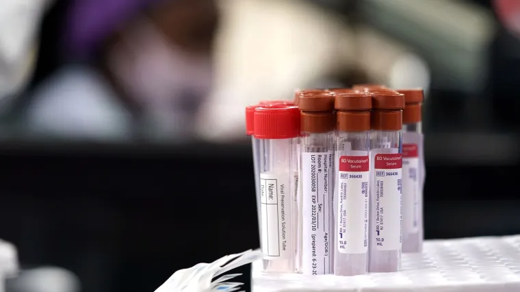 Velik broj umrlih: &Scaron;vedska osniva povjerenstvo za procjenu odgovora na pandemiju