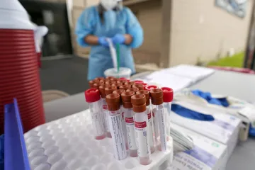 U Srbiji još 11 žrtava covida-19, registrirano 266 novih zaraza: Velik broj pozitivnih i u BiH