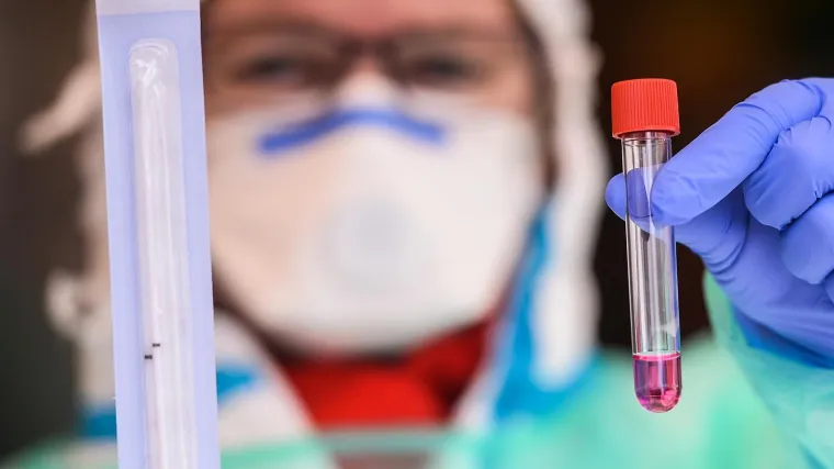 Zaražen jedan zatvorenik istražnog zatvora, 10 policajaca i 2 medicinske sestre u samoizolaciji