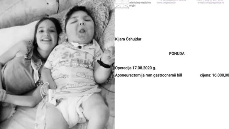 Očajna majka moli za pomoć za operaciju: 'Kao grom me pogodio pogled na kćer. Djeca na plaži su joj se rugala'