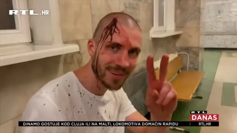 Bjelorusi na ulicama: Luka&scaron;enko optužen za manipulaciju glasovima. Policija brutalna prema prosvjednicima