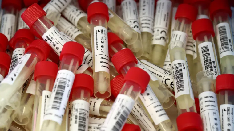 Testirali stotine tisuća ljudi nakon povratka u Njemačku, ali nisu im rekli rezultate. 900 ljudi zaraženo, a to ne zna