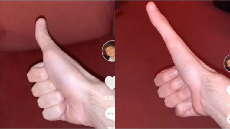 Može ga produžiti do neprepoznatljivosti; Gledajte samo ako imate jak želudac