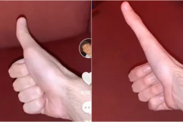 Može ga produžiti do neprepoznatljivosti; Gledajte samo ako imate jak želudac