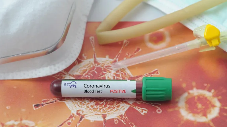 Jedan član se zarazio pa su svi u samoizolaciji